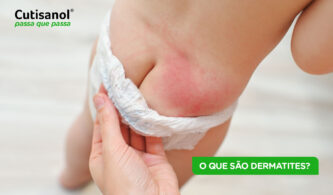 O que são dermatites? Um guia completo para todas as idades