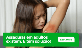 Assaduras em adultos: por que acontecem e como tratá-las