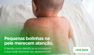 O que são brotoejas?